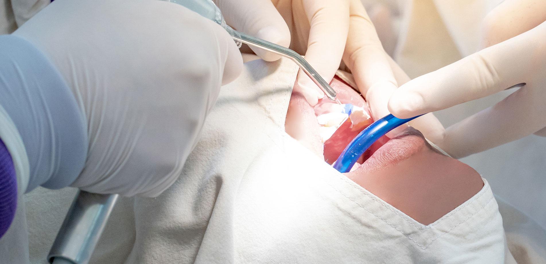 Dental Treatment with General Anesthesia